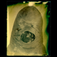 Illustration for article titled Photographer Captures Mesmeric Images of Parasitic Worm Sex